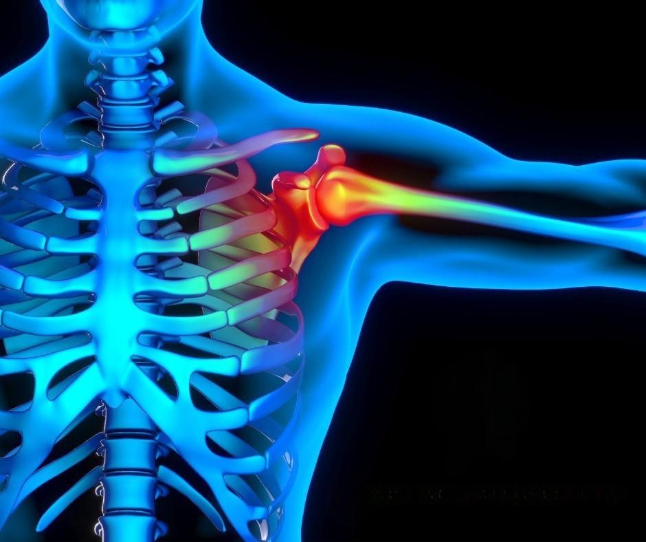 3D anatomical illustration of a human skeletal torso with a glowing red highlight on the shoulder joint, indicating inflammation or pain.